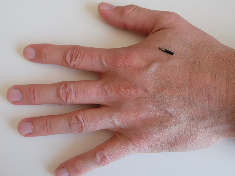 La puce transpondeur est implantée sous la peau.